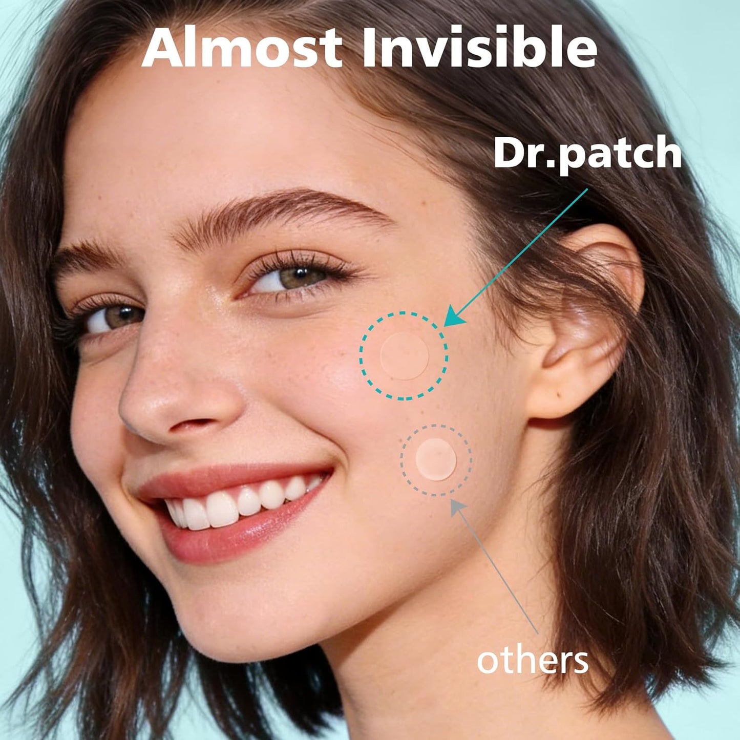 Hydrocolloid Acne Treatment Patches - 600 Count Assortment in Four Sizes, Enriched with Salicylic Acid, Tea Tree Oil, and Calendula Oil for Targeted Spot Treatment of Acne and Blemishes